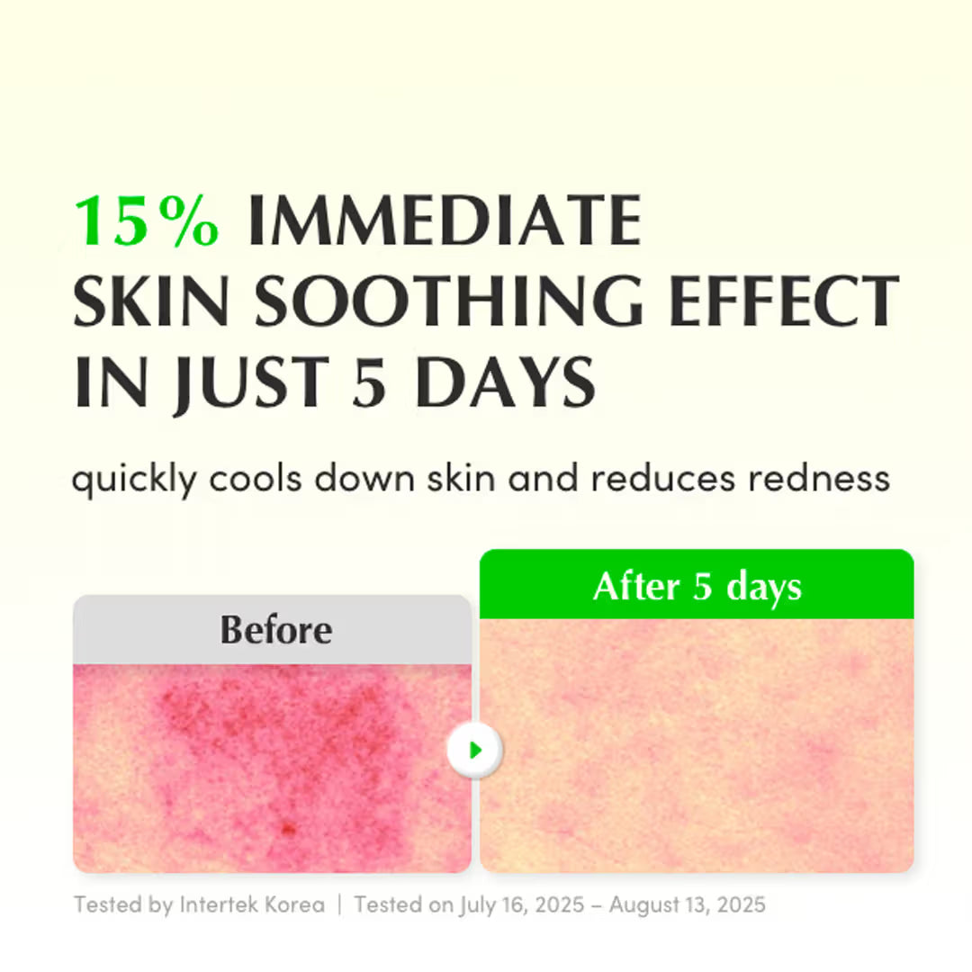 Eqqualberry Green Aid Aloe PDRN Calming Serum 30ML