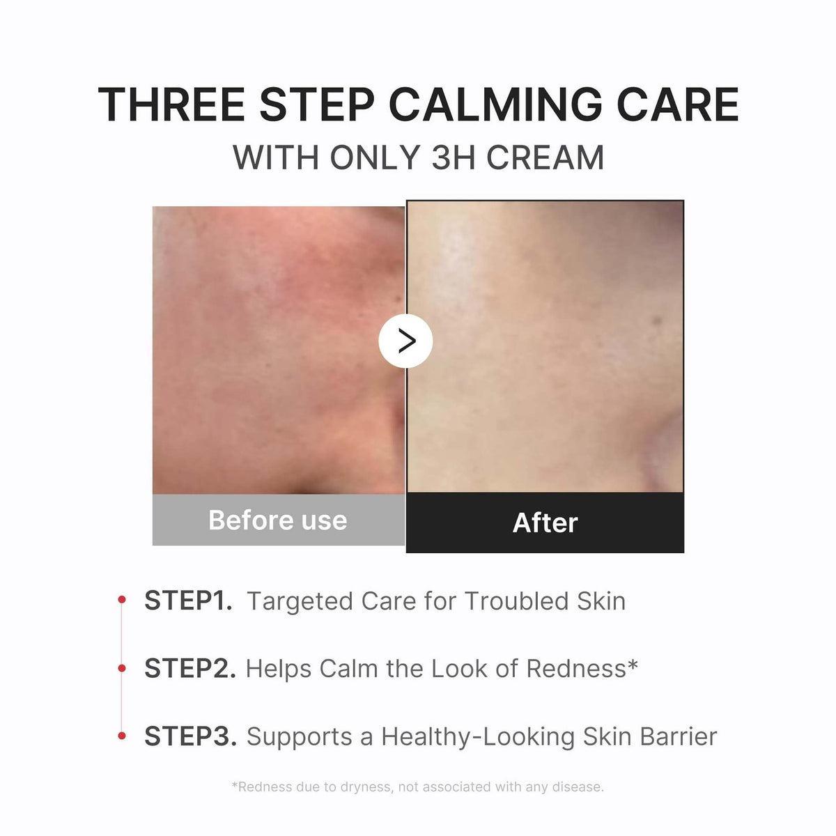 Medicube Daily Relief Cream hydrating soothing moisturizer 02
