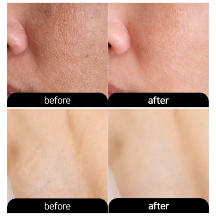 3W CLINIC Underarm Whitening Multi Cream 100g Korean brightening body cream for dark underarms
