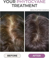 Phyto Phytocyane Hair Thinning Food Supplement 84 Capsules