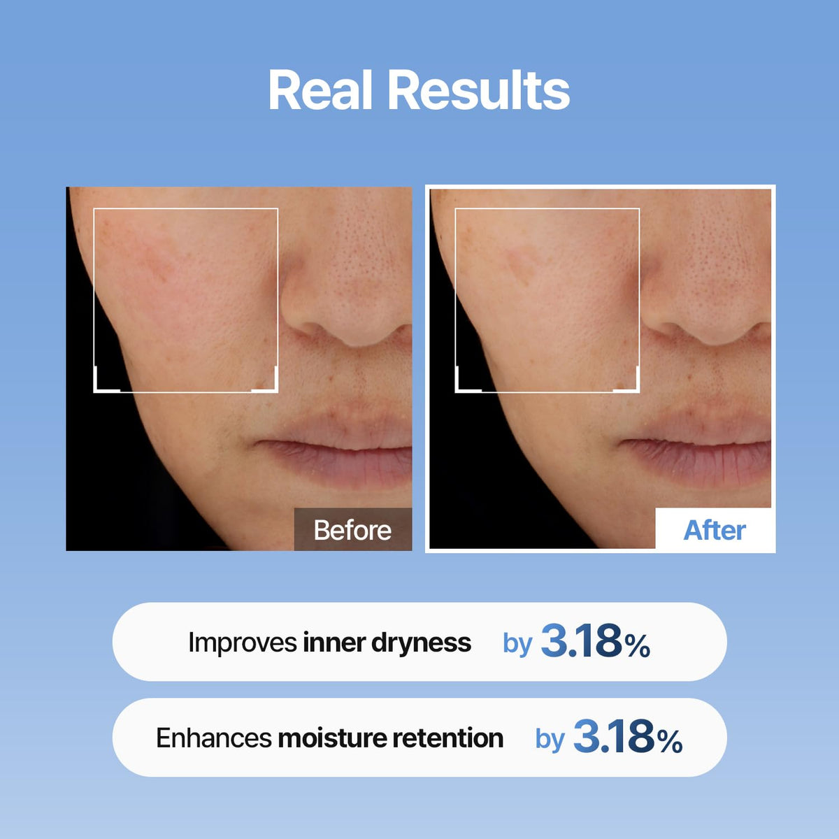 Meditherapy Hyaluronic Acid Skin Booster First Serum 150ML