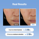 Meditherapy Hyaluronic Acid Skin Booster First Serum 150ML
