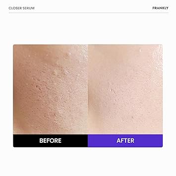 FRANKLY Closer Pore Reducing Serum 30ML