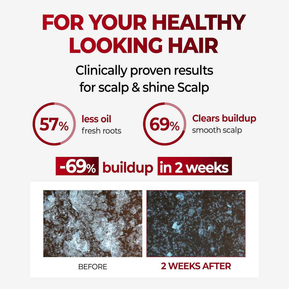 KUNDAL Scalp Care+ Caffeine Anti-Hair Loss Shampoo White Musk 500ML