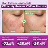 Jumiso Niacinamide 10 + TXA 4 Serum 40ML