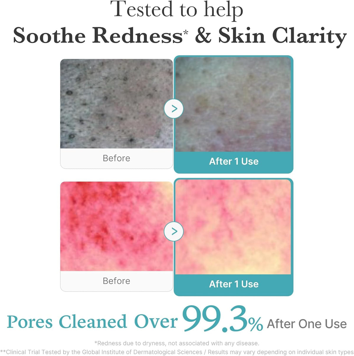 medicube Azelaic Acid Gummy Whip Cleanser