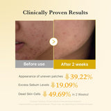 
medicube Kojic Acid Renew & Smooth Duo for Troubled