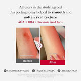 medicube-red-acne-body-peeling-shot-
