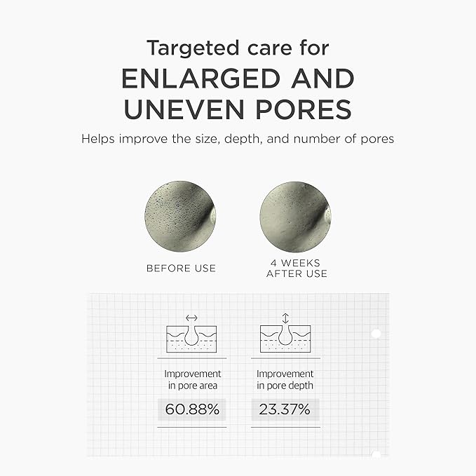 Niacinamide serum for enlarged pores and blackheads improving skin clarity and reducing oiliness