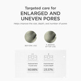 Niacinamide serum for enlarged pores and blackheads improving skin clarity and reducing oiliness