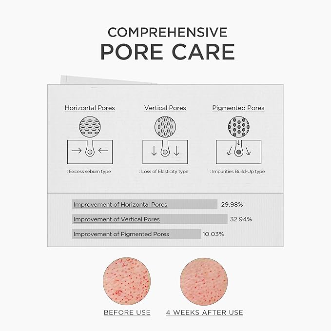 Pore minimizing effect of SKIN1004 niacinamide serum for smoother and clearer skin texture